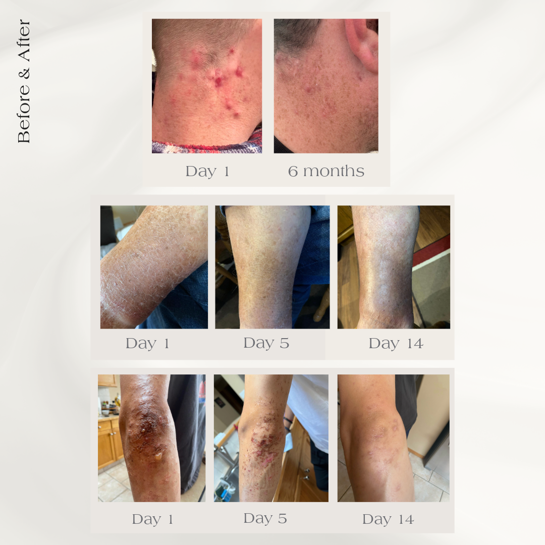 Le Pois DayFix